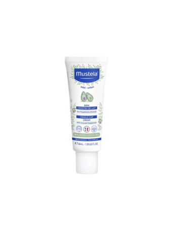 https://topara.tn/accueil/243-mustela-soin-croute-de-lait-40ml.html